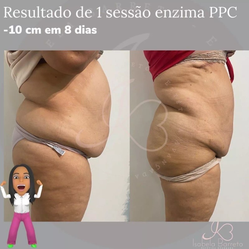 Monnaskin MESOLIPO PPC Cream Monnaskin 50g