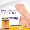 Uñas Amarillas Onicomicosis Hongos Nailex Solución Con 15 Ml