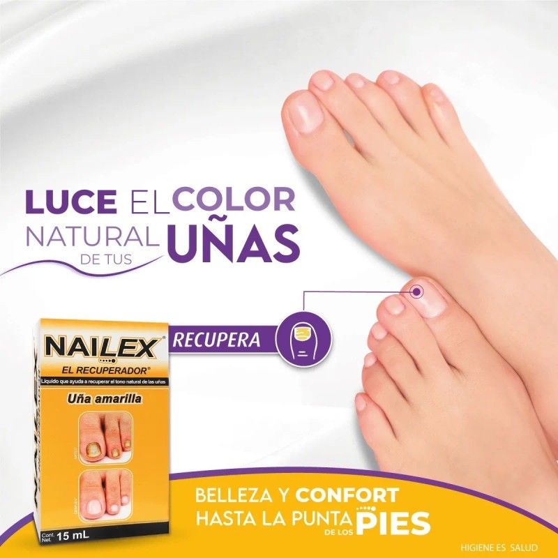 Uñas Amarillas Onicomicosis Hongos Nailex Solución Con 15 Ml