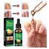 M Jaysuing Tratamiento Hongos De Uñas Herbal 30ml Neutra