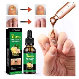 M Jaysuing Tratamiento Hongos De Uñas Herbal 30ml Neutra