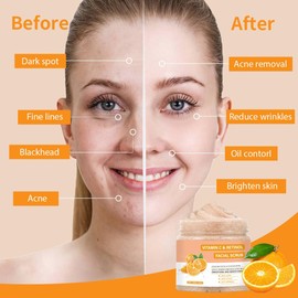 IREV- Exfoliante facial con vitamina C, lavado facial exfoliante con retinol, exfoliante facial, exfoliante facial, exfoliante facial