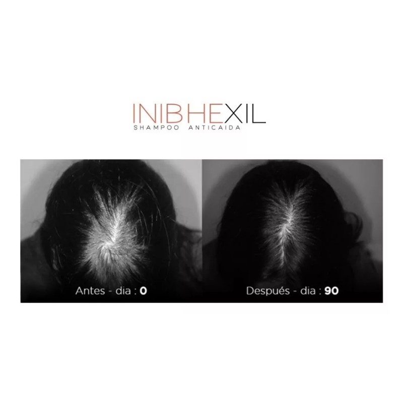 Spaesthetic Promocion 2 Shampoo Anticaida De 500 Ml