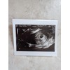 Prank 2D Customized Fake Ultrasound Single Photo ONLY NO Gender