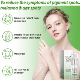 2 Stück Pigmentflecken Entferner Gesicht,Creme Gegen Pigmentflecken,Altersflecken Entfernen Gesicht,Dark Spot Correcting Glow Serum,Bright Niacinamide Serum Gegen Dunkle Flecken,Hellt den auf