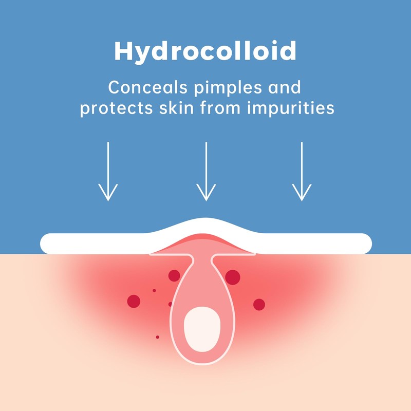 Pimple Patches for Face, Pimple Patch Zit, Invisible Hydrocolloid Patch