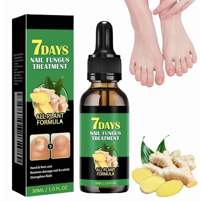JAYSUING Ginger Nail Treatment-Vitamin E & Plant Extracts for Repairing