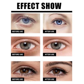 Lutein Eye Essence Oil,Vitamin C Lutein Eye Serum Oil,VC Rollerball E-ye Serum Brightening Ey-e Cream,Anti Aging E-ye Ser-um,Moisturizing E-ye Tightening Cream,Lu-tein Rollerball Essential O-il