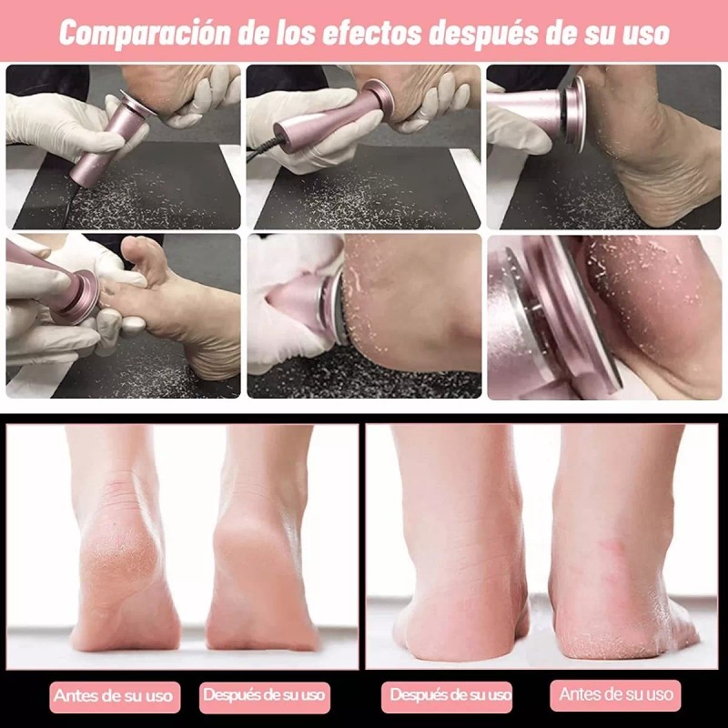 MYBEAUTY Maquina Exfoliadora De Callos Profesional De Eléctrico