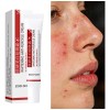 Crema Despigmentante Anti Manchas Zoo·son 20g