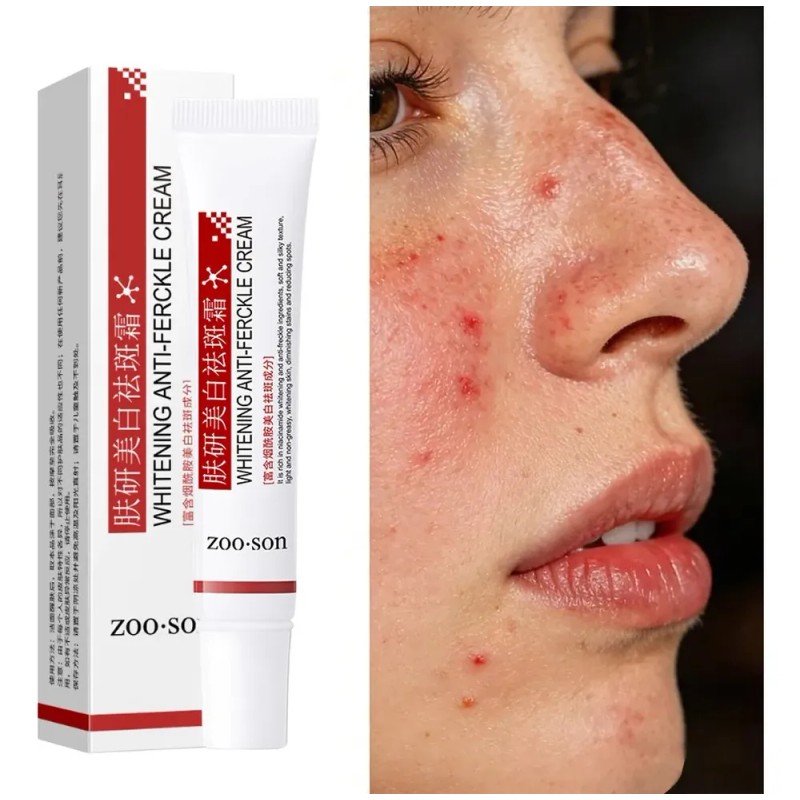 Crema Despigmentante Anti Manchas Zoo·son 20g