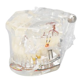 Disease Teeth Model Portable Acrylic Teaching Dental Implant Teeth Model for Clinic Transparent