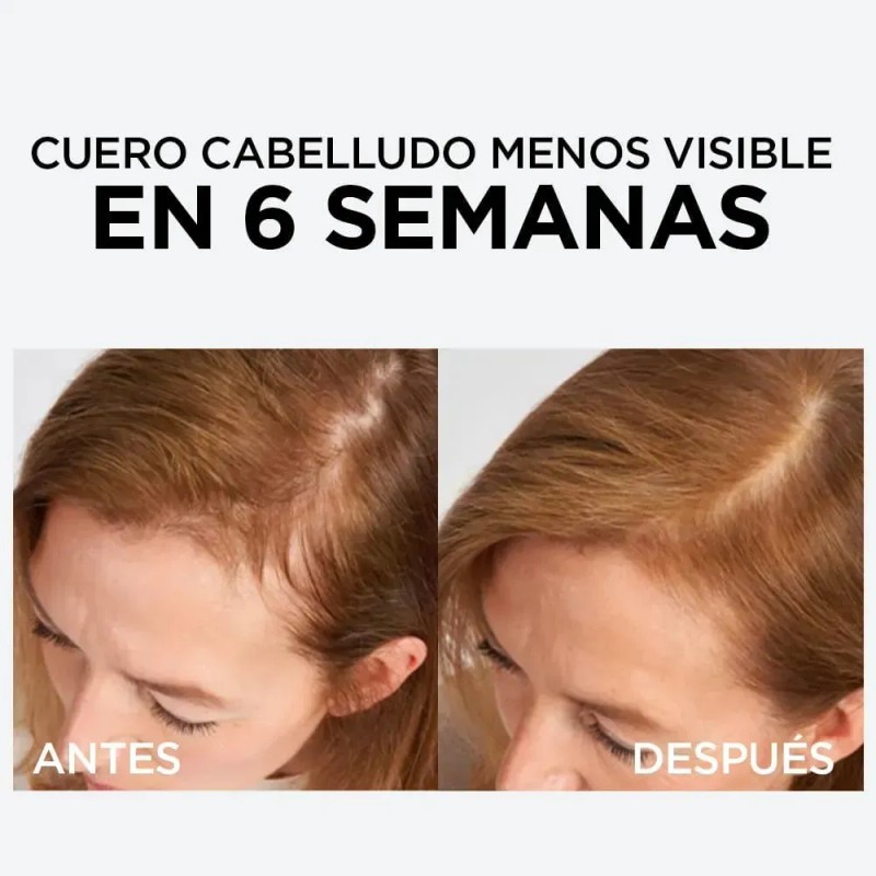 L'Oréal Paris Sérum capilar anti quiebre con 1.5% Aminexil Elvive