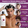 Onion Shampoo,Shampoo Reparación Brillante y Nutrición,Champú Extracto de Romero, Cebolla