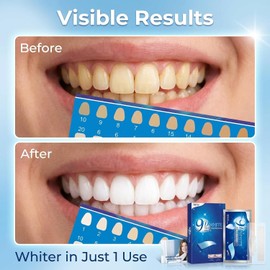 30 Piezas Tiras Blanqueadoras Dientes, 15 Pares Teeth Whitening Strips, Blanqueador Dental en Casa, Sabor Menta Refresca Respiración, Efectivo Eliminar para el Café,Tabaco y Otras Manchas (Azul, 15Pares)