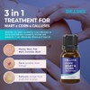 Plantar Wart & Corn Freeze Off for Feet: Exclusive Formula