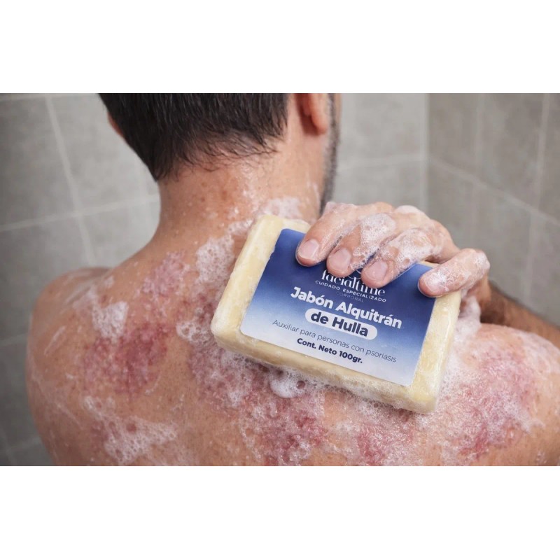 Kit Completo Psoriasis 2 Urea 2 Crema 2 Jabon Alquitran