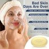 Sulfur Soap - Medical Grade OTC Dermatologists Approved 40 yrs