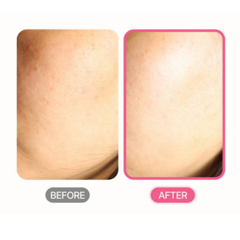 Bolayon Lotionique Mildly Acidic Toner 500ml+Sample / 볼라욘 로셔니끄 약산성