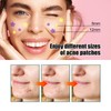 1 Acne Patch Star, Tea Tree Oil Spot Sticker, Water