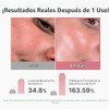 medicube Mascarilla facial rosa con recubrimiento de vitaminas y ADN