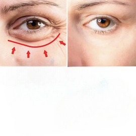 Cerave Skin Renewing Eye Cream Reduces puffiness & Spots, 0.5 oz [USA Warehouse]