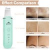 Skin Scrubber Face Skin Spatula Facial Scrubber Spatula Pore Cleaner
