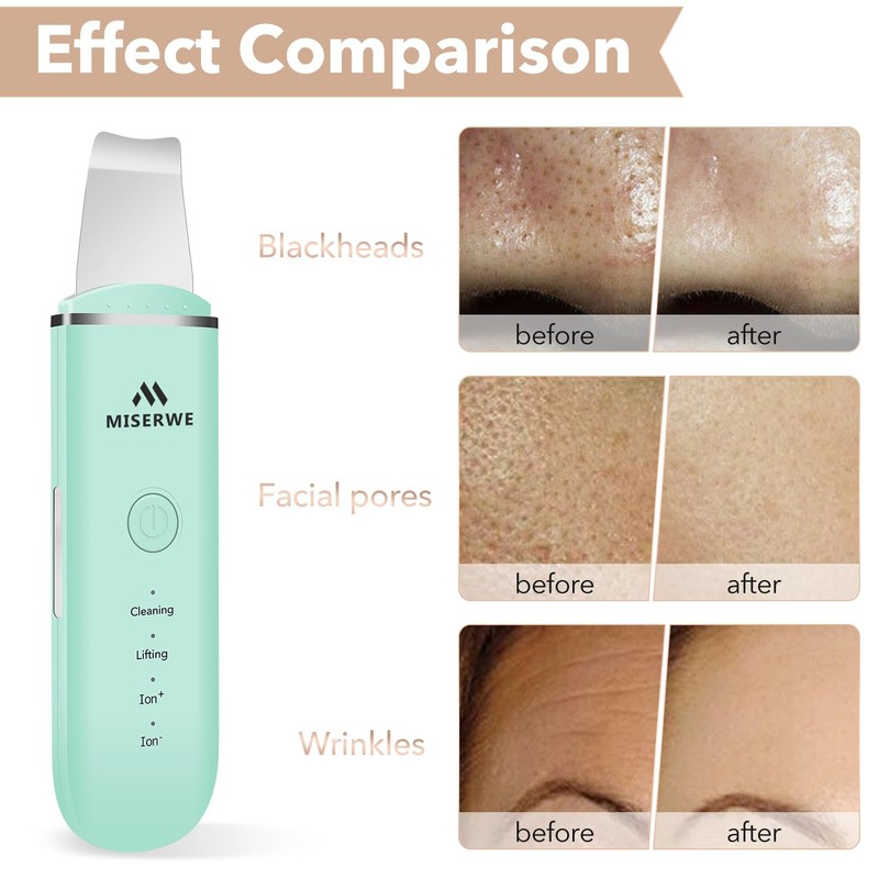 Skin Scrubber Face Skin Spatula Facial Scrubber Spatula Pore Cleaner