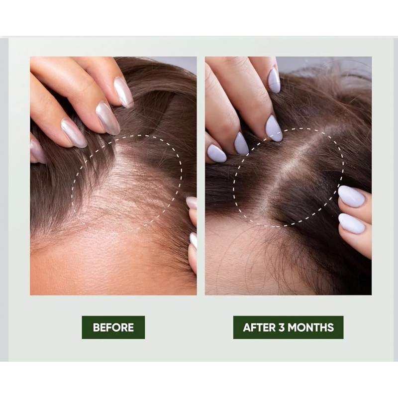 Svvimer Rosemary Hair Growth Shampoo/Condit