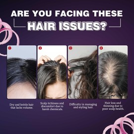 Onion Rosemary Shampoo Soap Bar, Natural Hair Care, Gentle Cleansing, 100g, Suitable for All Hair Types