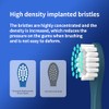 Cabezales De Repuesto Para Cepillos De Dientes Eléctricos Suri Sonic,