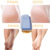 Professional foot rasp for pedicure calluses feet removal | foot