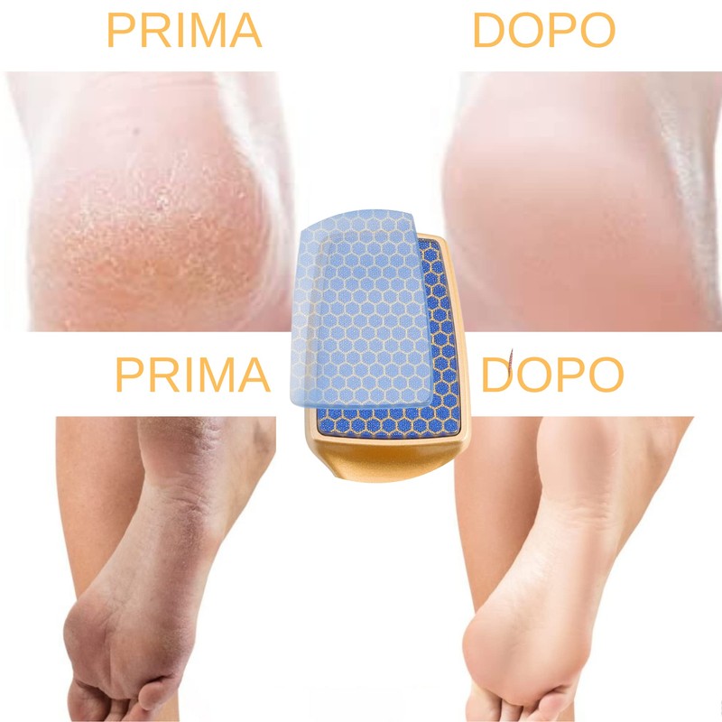 Professional foot rasp for pedicure calluses feet removal | foot
