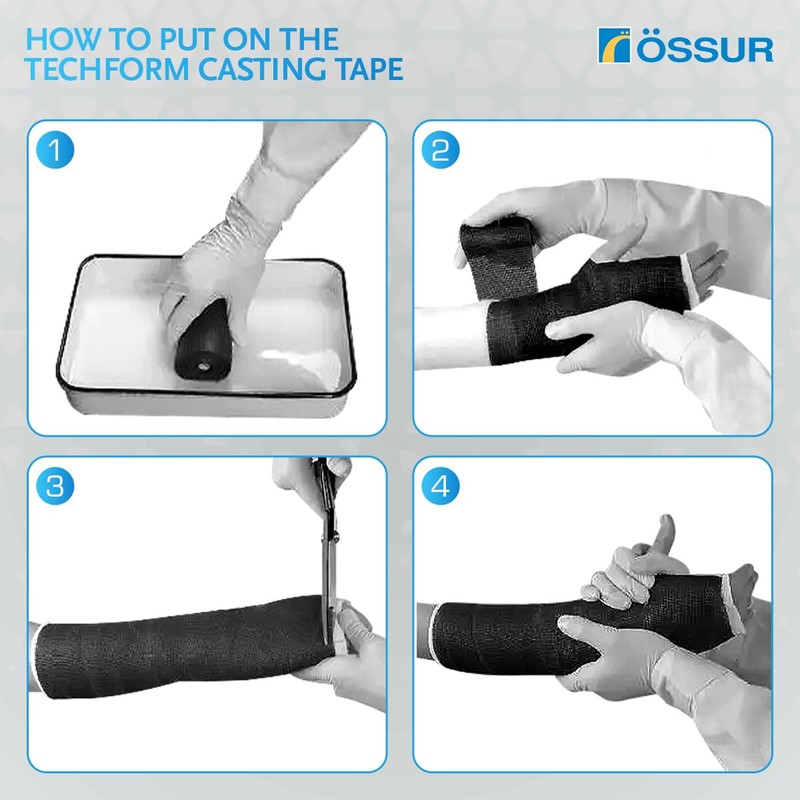 Össur Techform Premium Casting Tape Orthopedic Casting Material for Fracture