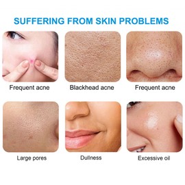 ARCHIDATE Salicylic Acid Pads, Acne Cleansing Pad, Deep Clean Pores, Reduce Acne, Breakouts, Blackheads, Oil Control, Minimize Enlarged Pore, Balance Water and Oil, Improve Rough Skin, 55 Pads