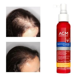 Loción Anticaída Acm Novophane 100ml