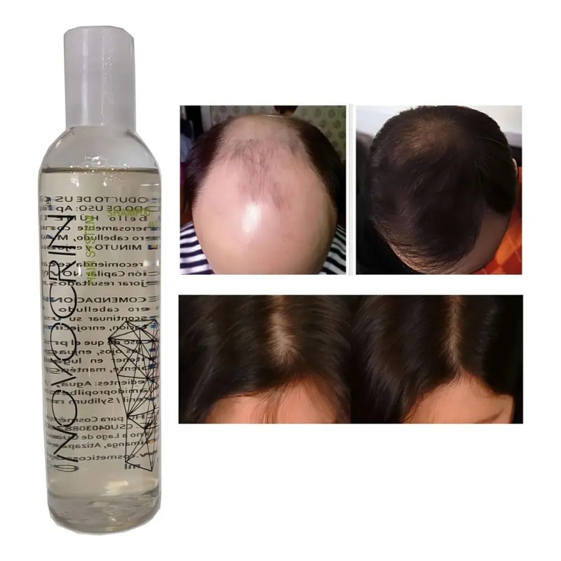 Shampoo Estimulación Del Folículo, Mxshw-001, 1 Pza, 250ml