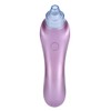 4 Replaceable Heads Blackhead Vacuum Removal Pore Acne Suction Cleanser