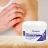 TriDerma Psoriasis Control Face & Body Cream, No Cortisone, Moisturizing