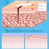 1pcs Emergency Wound Closures Adhesive Seamless Cuttable Hygienic Zip Stitch