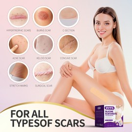 Medical Silicone Scar Sheets with Silicone Gel – Reusable Scar Tape for C-Section, Surgery, Keloids & Burns, 4cm x 1.5m (1.6" x 60") (Nude)