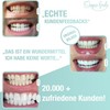 UniqueSmile High-Quality Teeth Whitening Kit, All-in-One Bundle for Teeth Brightening