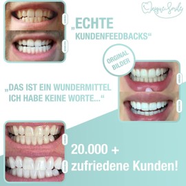 UniqueSmile High-Quality Teeth Whitening Kit, All-in-One Bundle for Teeth Brightening and White Teeth, Teeth Bleaching Set blue