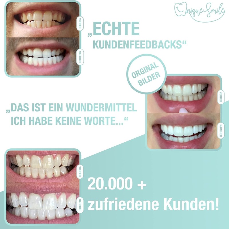 UniqueSmile High-Quality Teeth Whitening Kit, All-in-One Bundle for Teeth Brightening