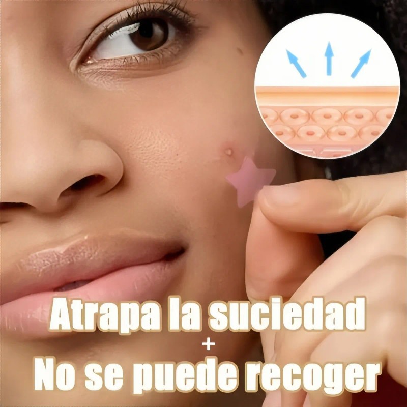 280pzs Mascarillas Estrella Acne