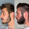 The Beard Club Titanium Beard Growth Kit - Derma Roller,