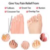 ZYFC 4 Pack Gel Pinky Toe Separators, Double Hole Toe