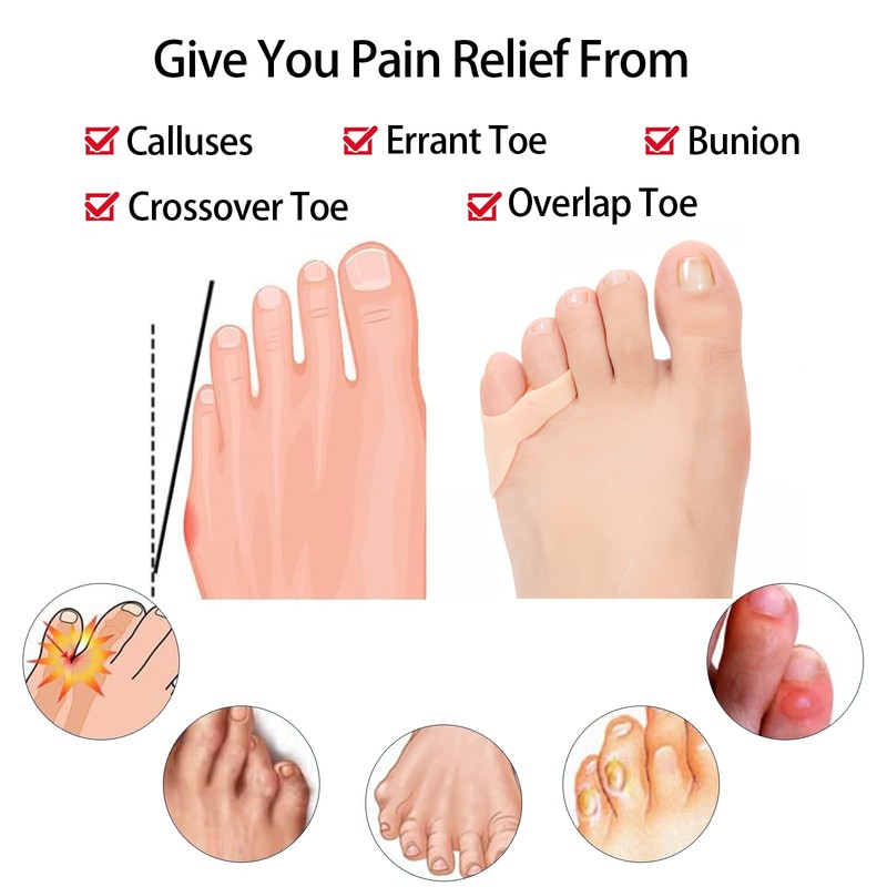 ZYFC 4 Pack Gel Pinky Toe Separators, Double Hole Toe