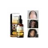 Serum Concentrado Gengibre Natural Crecimiento Cabello 30ml