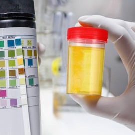 iplusmile 10 Pieces Urine Cups Sample Cups with Lid 60 ml Urine Sample Cup Urine Tube Urine Cups Ovulation Test Cup Sample Tube for Pregnancy Test Laboratory Random Colour